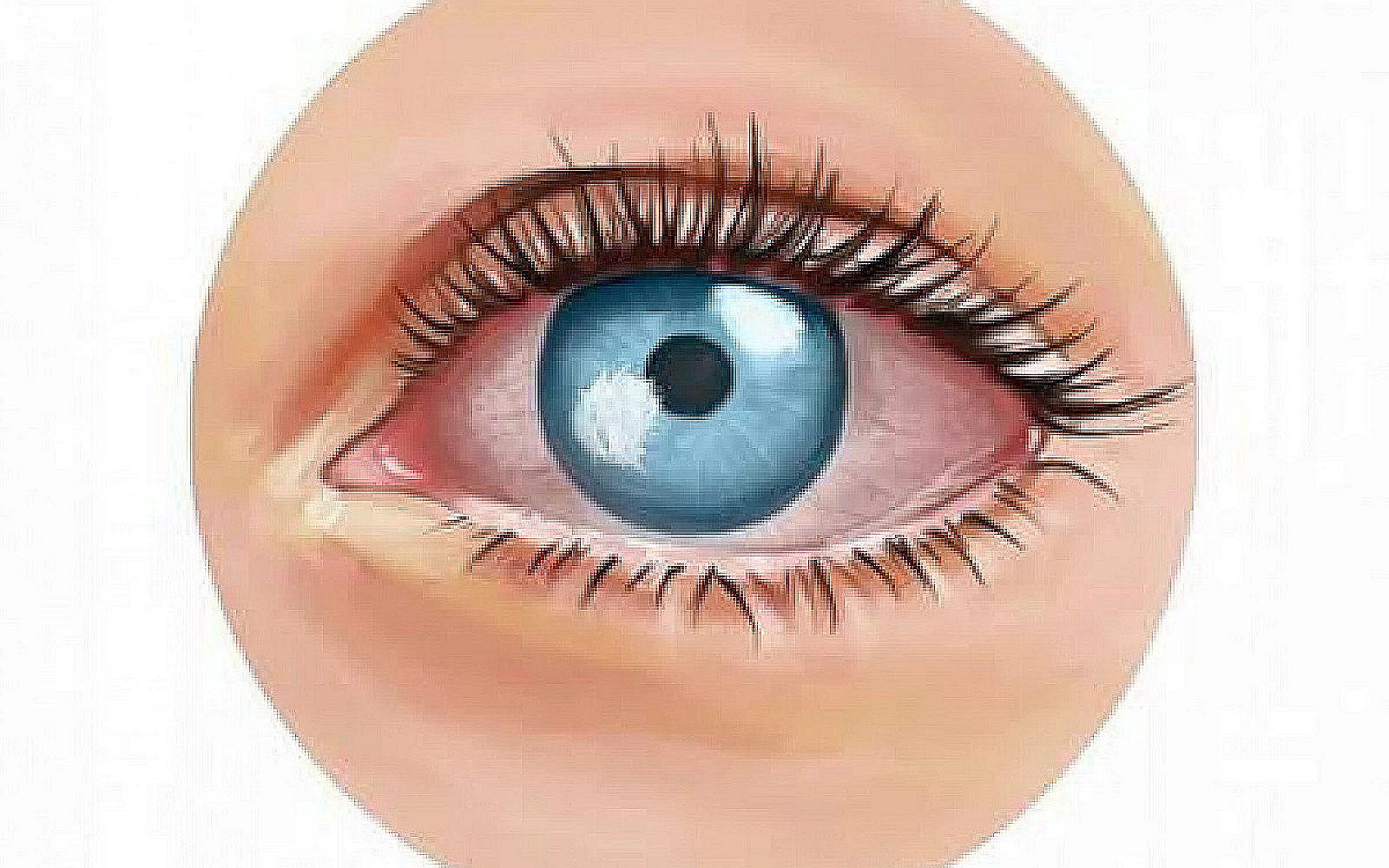 Retirer les lentilles en cas de douleur